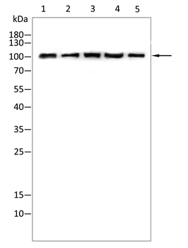 HK2 Antibody