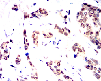 ETV4 Antibody