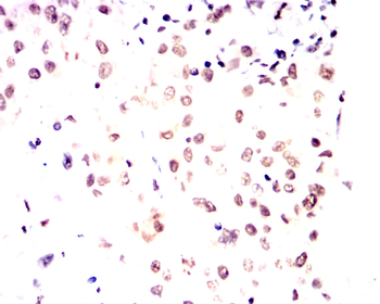ETV4 Antibody