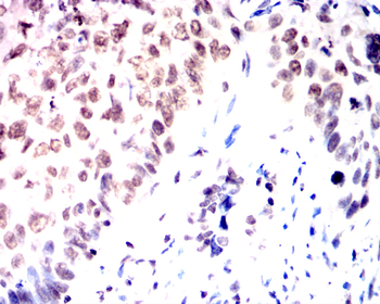 ETV4 Antibody
