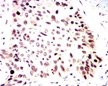 ETV4 Antibody