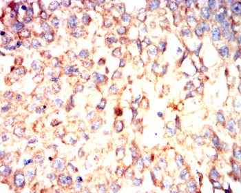 SHH Antibody