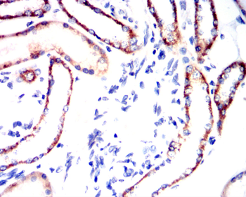 ACP5 Antibody