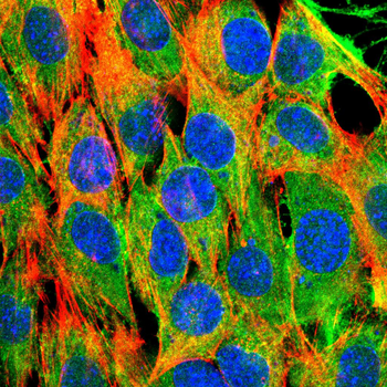 SST Antibody