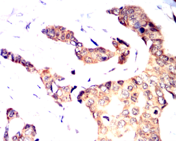 SST Antibody