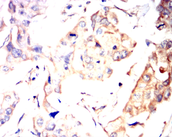 BMPR2 Antibody