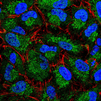 SLC2A4 Antibody