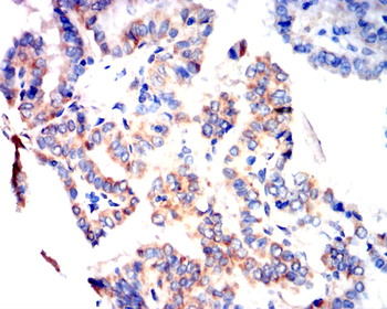 SLC2A4 Antibody