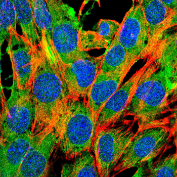 DDR2 Antibody
