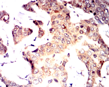 DDR2 Antibody