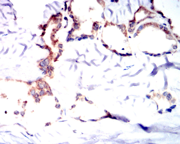 DDR2 Antibody
