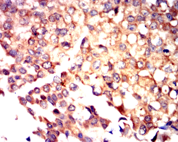 RICTOR Antibody