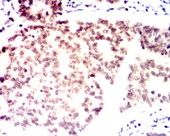 RICTOR Antibody