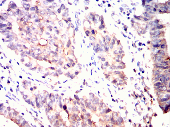 AHNAK Antibody