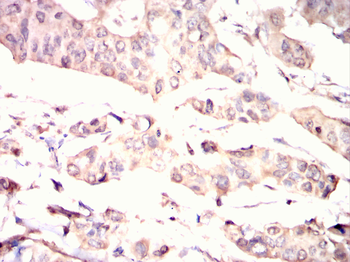 ZBTB16 Antibody