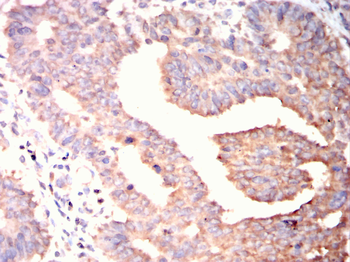 ZBTB16 Antibody