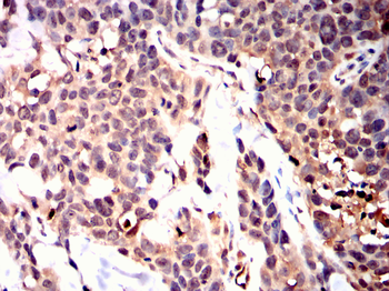 ZBTB16 Antibody