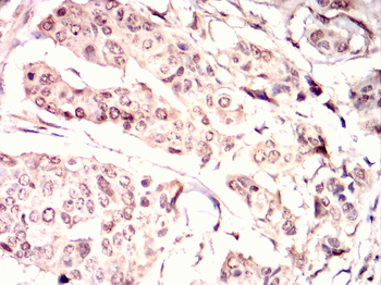 KLRD1 Antibody