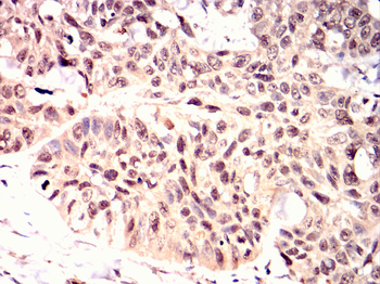 KLRD1 Antibody