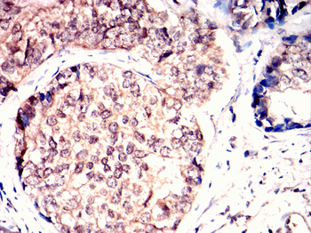 KLRD1 Antibody