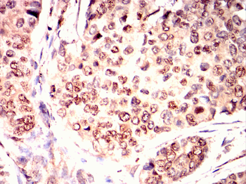 BLNK Antibody