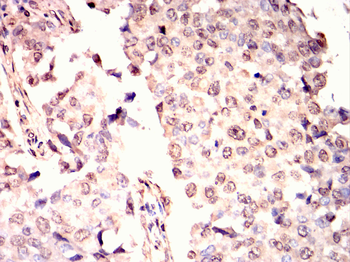 BLNK Antibody
