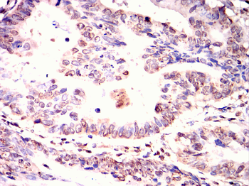 BLNK Antibody