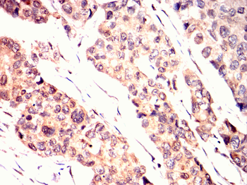 PINK1 Antibody