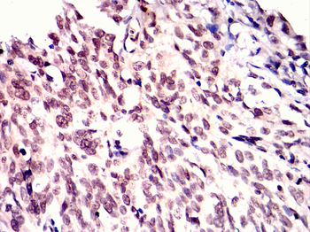 PINK1 Antibody
