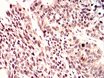 PINK1 Antibody