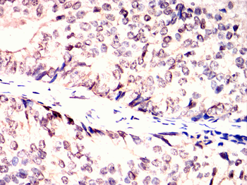 PINK1 Antibody