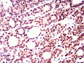 PINK1 Antibody