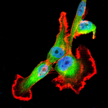SQSTM1 Antibody