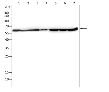 SQSTM1 Antibody