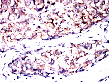 CFLAR Antibody
