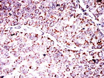 MAP2K7 Antibody