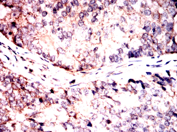 MAP2K7 Antibody