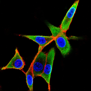 ABCB5 Antibody