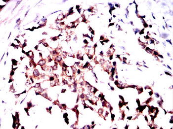 ABCB5 Antibody
