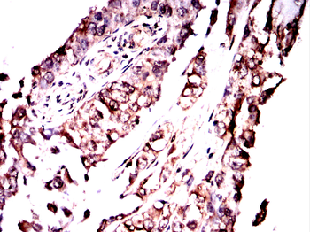 ABCB5 Antibody