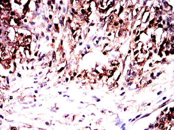ABCB5 Antibody