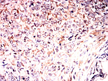 ABCB5 Antibody
