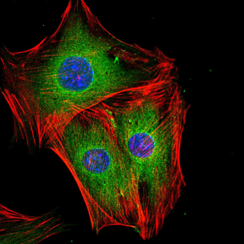 CAMK4 Antibody