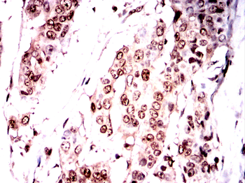 CAMK4 Antibody