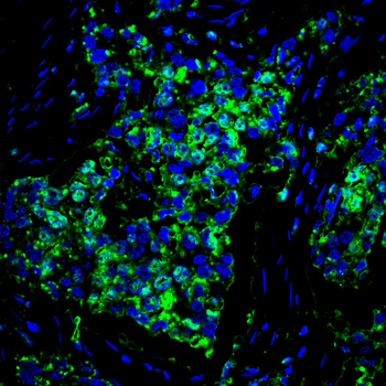 CAMK4 Antibody