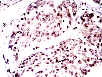 CAMK4 Antibody