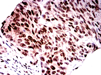 CAMK4 Antibody