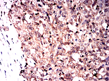 CAMK4 Antibody