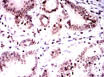 CAMK4 Antibody