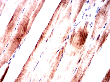 SQSTM1 Antibody